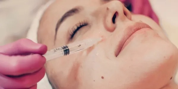 Facial filler treatment for cheeks and jawline